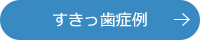 すきっ歯症例